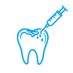 dental-sealants-in-Westerville -OH-150x150